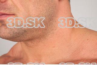 Neck texture of Gene 0001